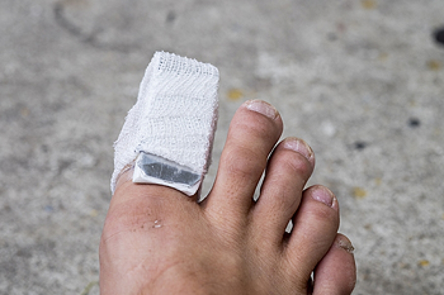 Symptoms Of A Broken Toe