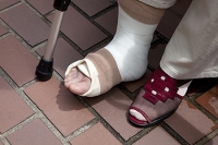 Symptoms of a Broken Foot